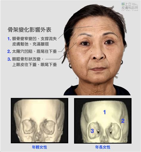 夫妻宮凹陷化解|夫妻宮凹陷會怎樣？面相看婚姻危機，小心！ 